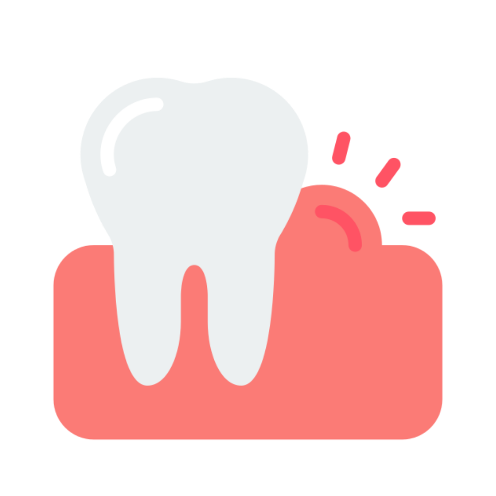 เหงือกบวม